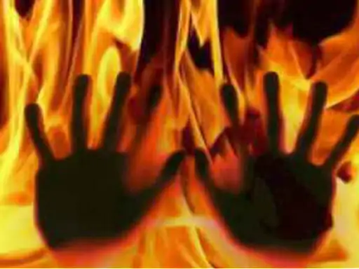 गोरखपुर में बुजुर्ग ने खुद को लगाई आग