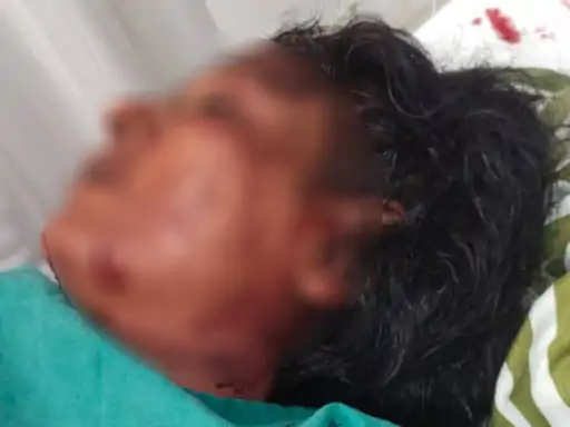 बरेली में स्टाफ नर्स पर चाकू से हमला