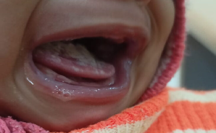 इलाज न करा पाने की बेबसी में मां ने बीमार दुधमुंही बेटी की तालाब में फेंककर की हत्या