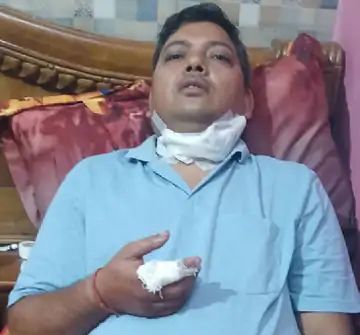 वाराणसी में एडवोकेट का गला चाइनीज मांझे से कटा, 4 टांके लगे