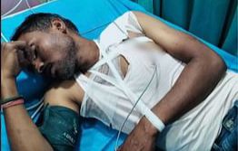 बनारस बार एसोसिएशन अध्यक्ष की कार पर फायरिंग, मैकेनिक घायल; हत्या के प्रयास का मामला दर्ज