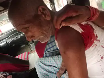 वाराणसी में परचून दुकानदार को गोली मारने से सनसनी, मामूली विवाद के बाद फायरिंग; बुजुर्ग घायल